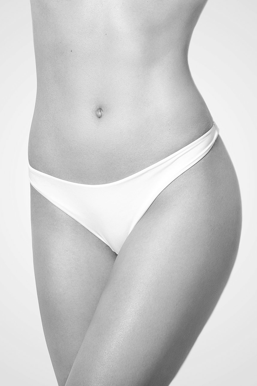 Abdominoplastia